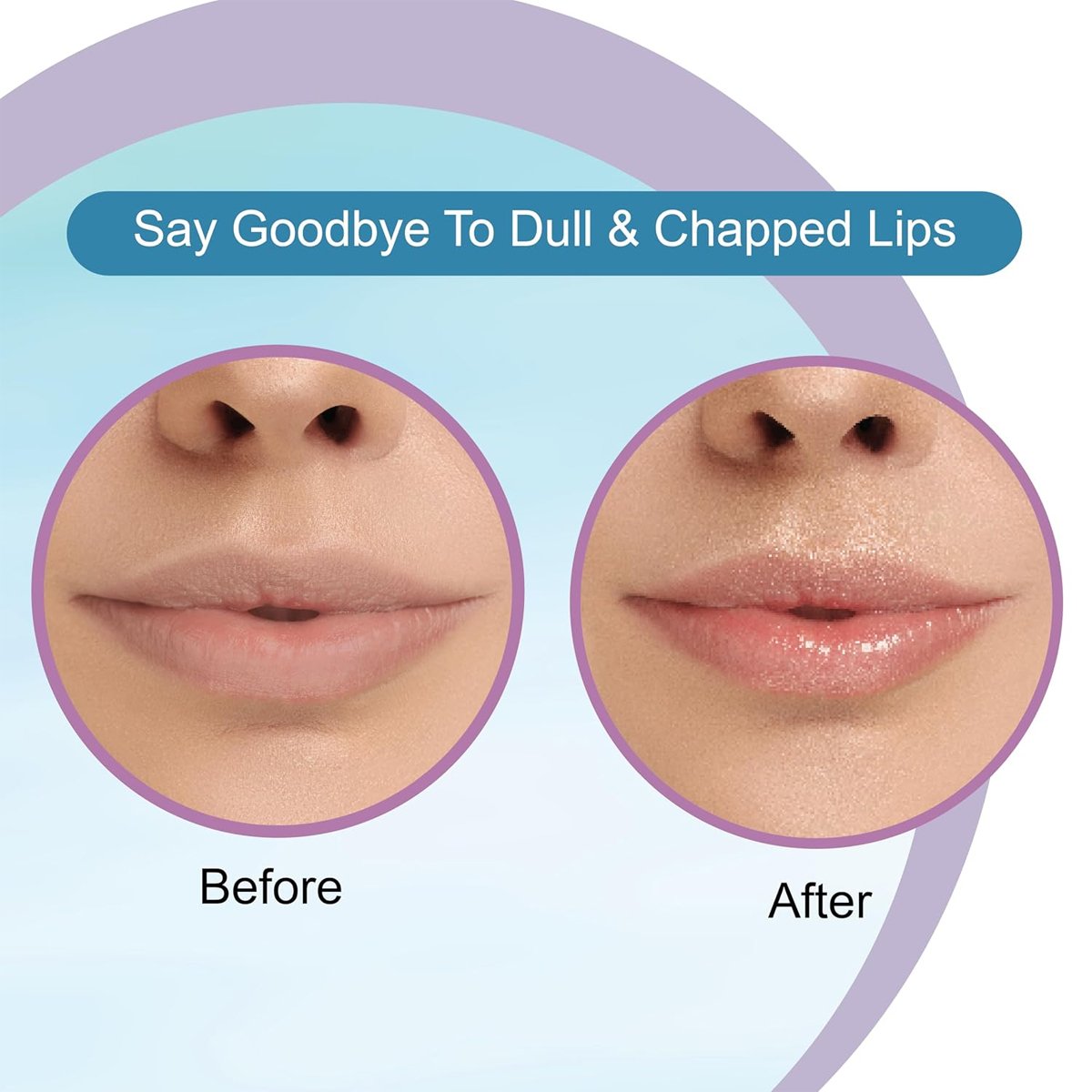 Dr. Rashel Hyaluronic Lip Balm — 5 g - Image 7