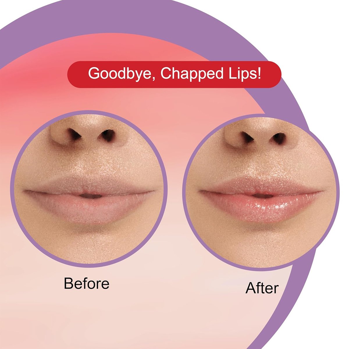 Dr. Rashel Watermelon Lip Balm — 5 g - Image 7