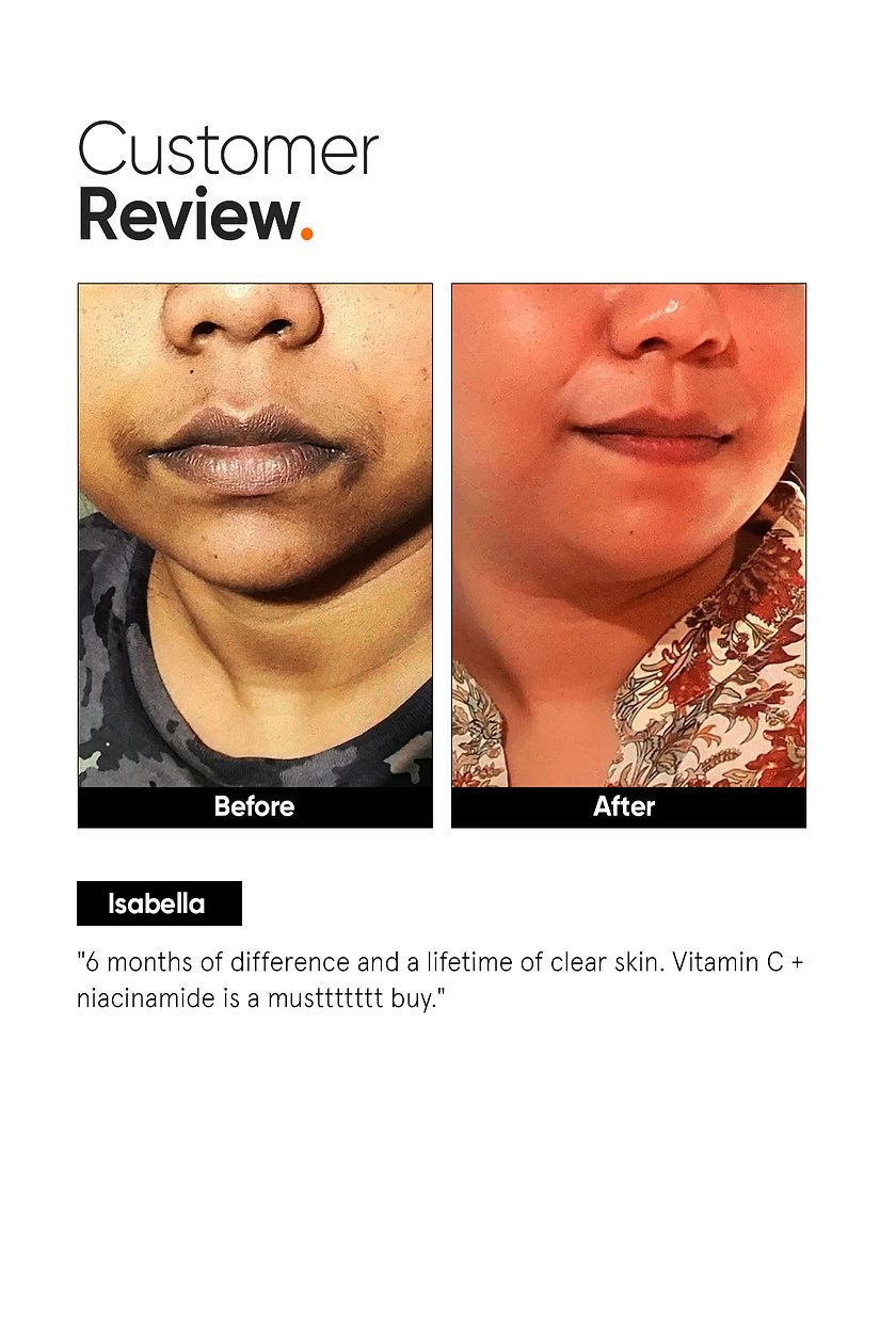 Minimalist Vitamin C + E + Ferulic 16% Face Serum – Antioxidant-Focused Facial Care - Image 5